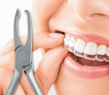 PLIERS FOR CLEAR ALIGNERS